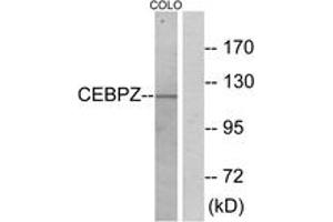Western blot analysis of extracts from COLO cells, using CEBPZ Antibody. (CEBPZ 抗体  (AA 1-50))