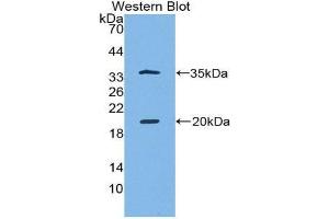 Western Blotting (WB) image for anti-serine Peptidase Inhibitor, Kazal Type 5 (SPINK5) (AA 699-976) antibody (ABIN1860613) (SPINK5 抗体  (AA 699-976))