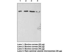 Image no. 1 for anti-Prostaglandin F Receptor (FP) (PTGFR) antibody (ABIN2450569)