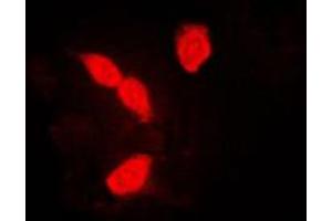 Immunofluorescent analysis of hnRNP A1 staining in K562 cells. (HNRNPA1 抗体  (Center))