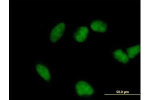 Immunofluorescence of purified MaxPab antibody to FHL3 on HeLa cell. (FHL3 抗体  (AA 1-280))