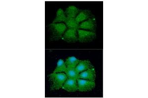 ICC/IF analysis of CDKN1b in Hep3B cells line, stained with DAPI (Blue) for nucleus staining and monoclonal anti-human CDKN1b antibody (1:100) with goat anti-mouse IgG-Alexa fluor 488 conjugate (Green). (CDKN1B 抗体  (AA 1-198))