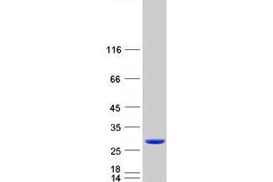 Validation with Western Blot (MYL6B Protein (Myc-DYKDDDDK Tag))