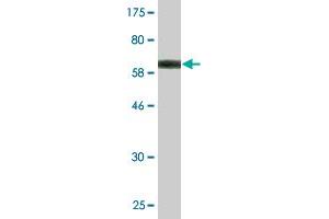 Western Blotting (WB) image for anti-Homogentisate 1,2-Dioxygenase (HGD) (AA 1-329) antibody (ABIN516423)