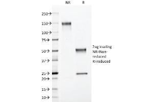 SDS-PAGE (SDS) image for anti-S100 Calcium Binding Protein B (S100B) antibody (ABIN6940555)