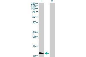 Western Blot analysis of ZNF695 expression in transfected 293T cell line by ZNF695 MaxPab polyclonal antibody. (ZNF695 抗体  (AA 1-133))