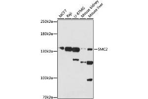 Western blot analysis of extracts of various cells, using SMC2 antibody (ABIN7270615) at 1:1000 dilution. (SMC2 抗体  (AA 700-900))
