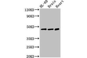 Western Blot Positive WB detected in: HL60 whole cell lysate, Mouse brain tissue, Rat heart tissue All lanes: CHST1 antibody at 3 μg/mL Secondary Goat polyclonal to rabbit IgG at 1/50000 dilution Predicted band size: 47 kDa Observed band size: 47 kDa (CHST1 抗体  (AA 305-397))