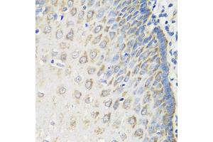 Immunohistochemistry of paraffin-embedded human esophagus using MSRB2 antibody at dilution of 1:100 (40x lens). (MSRB2 抗体)