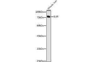 Western blot analysis of extracts of Mouse liver, using IL6R antibody (ABIN3015521, ABIN3015522, ABIN3015523, ABIN1680455 and ABIN6218635) at 1:1000 dilution. (IL-6 Receptor 抗体  (AA 20-320))