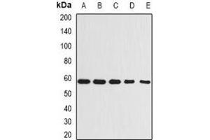 Western blot analysis of Beclin-1 expression in A431 (A), MCF7 (B), Raji (C), mouse kidney (D), rat brain (E) whole cell lysates. (Beclin 1 抗体)