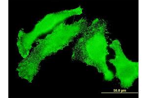 Immunofluorescence of monoclonal antibody to TAOK3 on HeLa cell. (TAO Kinase 3 抗体  (AA 809-898))