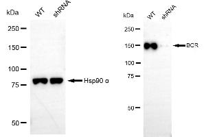 Western blotting analysis using BCR antibody (ABIN7797789).