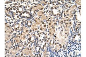 Immunohistochemistry (IHC) image for anti-Acidic (Leucine-Rich) Nuclear phosphoprotein 32 Family, Member E (ANP32E) (Middle Region) antibody (ABIN310810) (ANP32E 抗体  (Middle Region))