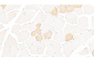 Immunohistochemistry (IHC) image for anti-Myosin Heavy Chain 1, Skeletal Muscle, Adult (MYH1) (AA 585-794) antibody (ABIN7432532)