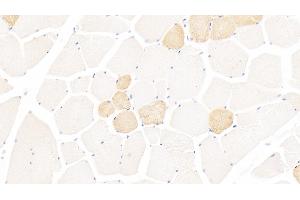 Detection of MYH1 in Human Skeletal muscle Tissue using Polyclonal Antibody to Myosin Heavy Chain 1 (MYH1) (MYH1 抗体  (AA 585-794))