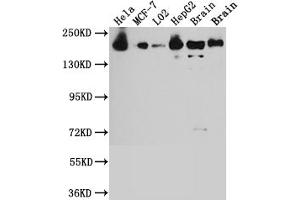 Western Blot Positive WB detected in: Hela whole cell lysate, MCF-7 whole cell lysate, L02 whole cell lysate, HepG2 whole cell lysate, Mouse Brain whole cell lysate, Rat Brain whole cell lysate All lanes: ROCK2 antibody at 1:1000 Secondary Goat polyclonal to rabbit IgG at 1/50000 dilution Predicted band size: 161 kDa Observed band size: 161 kDa (Recombinant ROCK2 抗体)