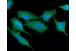 anti-Tumor Protein P53 Inducible Protein 3 (TP53I3) (AA 1-332) antibody