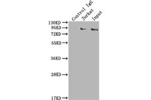Immunoprecipitating SUZ12 in K562 whole cell lysate Lane 1: Rabbit control IgG instead of ABIN7127832 in K562 whole cell lysate. (Recombinant SUZ12 抗体)