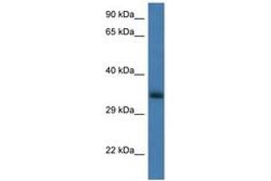 Image no. 1 for anti-Glucosamine-6-Phosphate Deaminase 1 (GNPDA1) (AA 50-99) antibody (ABIN6747378) (GNPDA1 抗体  (AA 50-99))
