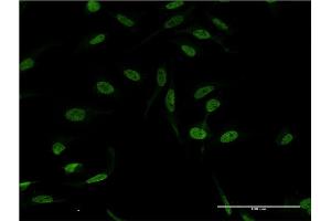 Immunofluorescence of monoclonal antibody to XPA on HeLa cell.