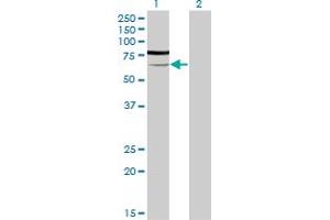 Western Blotting (WB) image for anti-Phosphoglucomutase 3 (PGM3) (AA 1-543) antibody (ABIN598868) (Phosphoglucomutase 3 抗体  (AA 1-543))