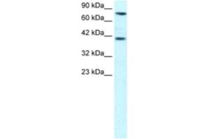 Western Blotting (WB) image for anti-Zinc Finger Protein 652 (ZNF652) antibody (ABIN2460271) (ZNF652 抗体)