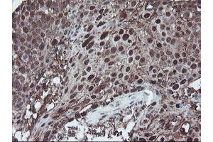 Image no. 8 for anti-SKI-Like Oncogene (SKIL) (AA 307-684) antibody (ABIN1491380)