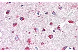 Detection of HEXb in Human Cerebrum Tissue using Polyclonal Antibody to Hexosaminidase B Beta (HEXb)