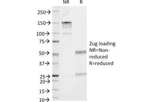 SDS-PAGE (SDS) image for anti-CD86 (CD86) antibody (ABIN6941142)