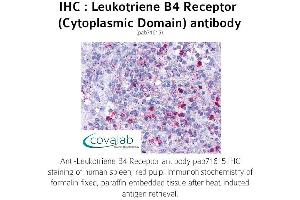 Image no. 1 for anti-Leukotriene B4 Receptor (LTB4R) (3rd Cytoplasmic Domain) antibody (ABIN1736422) (Leukotriene B4 Receptor/BLT 抗体  (3rd Cytoplasmic Domain))