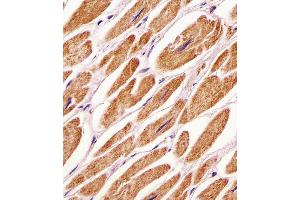 (ABIN391039 and ABIN2841206) staining PDK4 in human heart tissue sections by Immunohistochemistry (IHC-P - paraformaldehyde-fixed, paraffin-embedded sections). (PDK4 抗体  (C-Term))