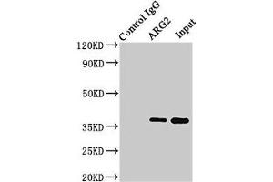 Immunoprecipitating ARG2 in HEK293 whole cell lysate Lane 1: Rabbit control IgG (1 μg) instead of ABIN7144586 in HEK293 whole cell lysate. (ARG2 抗体  (AA 1-354))