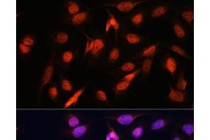 Immunofluorescence analysis of U2OS cells using OTUB1 Polyclonal Antibody at dilution of 1:100. (OTUB1 抗体)
