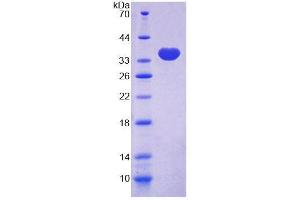 SDS-PAGE analysis of Human TLN2 Protein. (TLN2 蛋白)