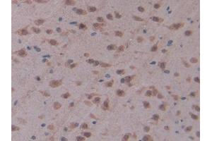 Immunohistochemistry (IHC) image for anti-CD28 (CD28) (AA 33-174) antibody (ABIN2118849)
