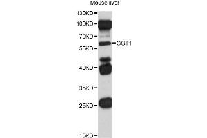 Western blot analysis of extracts of mouse liver, using GGT1 antibody (ABIN5970894) at 1/1000 dilution. (GGT1 抗体)