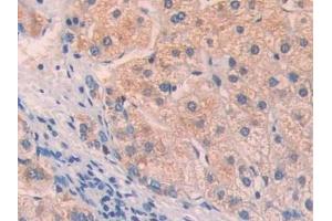 Immunohistochemistry (IHC) image for anti-Lysyl Oxidase-Like 4 (LOXL4) (AA 399-552) antibody (ABIN7437674)