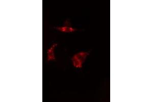 ABIN6277586 staining  HepG2 cells by IF/ICC. (TPT1 抗体  (Internal Region))