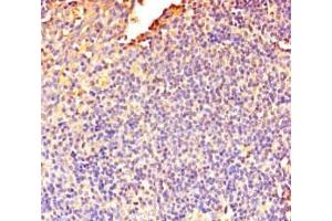 Immunohistochemistry of paraffin-embedded human tonsil tissue using ABIN7150574 at dilution of 1:100 (DOK5 抗体  (AA 1-198))