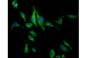Immunofluorescence staining of U251 cells with ABIN7163572 at 1:133, counter-stained with DAPI. (PEAR1 抗体  (AA 932-1037))