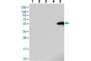 Western blot analysis of Lane 1: RT-4, Lane 2: U-251 MG, Lane 3: Human Plasma, Lane 4: Liver, Lane 5: Tonsil with IGSF11 polyclonal antibody . (IGSF11 抗体)