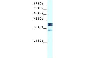 WB Suggested Anti-NR5A1 Antibody Titration:  20ug/ml  Positive Control:  Daudi cell lysate NR5A1 is supported by BioGPS gene expression data to be expressed in Daudi (NR5A1 抗体  (Middle Region))