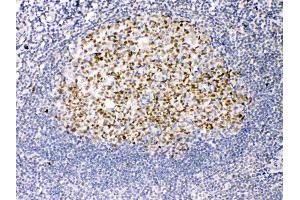 TRF2 was detected in paraffin-embedded sections of human tonsil tissues using rabbit anti- TRF2 Antigen Affinity purified polyclonal antibody (Catalog # ) at 1 µg/mL. (TRF2 抗体  (AA 81-287))