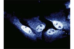Immunofluorescent staining of HeLa cells. (CDC27 抗体  (AA 145-343))