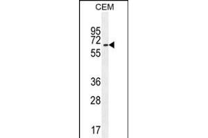 UNCX Antibody (C-term) (ABIN655115 and ABIN2844746) western blot analysis in CEM cell line lysates (35 μg/lane).