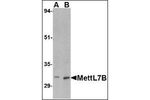 Western blot analysis of MettL7B in rat spleen tissue lysate with MettL7B antibody at (A) 2 and (B) 4 µg/ml (METTL7B 抗体  (C-Term))