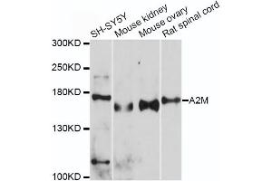 Western blot analysis of extracts of various cell lines, using A2M antibody (ABIN5970754) at 1/500 dilution. (alpha 2 Macroglobulin 抗体)