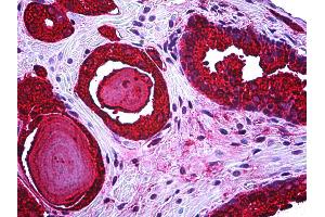 Anti-KLK3 / PSA antibody IHC of human prostate. (Prostate Specific Antigen 抗体)