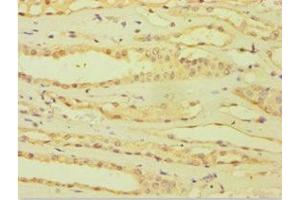 Immunohistochemistry of paraffin-embedded human kidney tissue using ABIN7144871 at dilution of 1:100 (ATP5J 抗体  (AA 1-108))